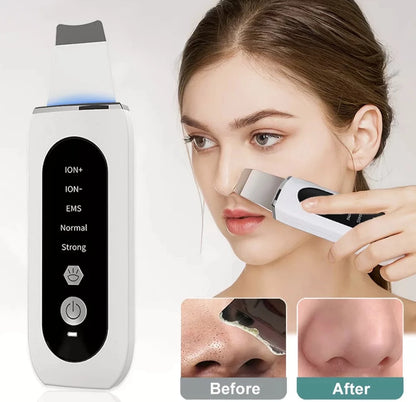 Ultrasonic Skin Scrubber Peeling Blackhead Remover Deep Face Cleaning